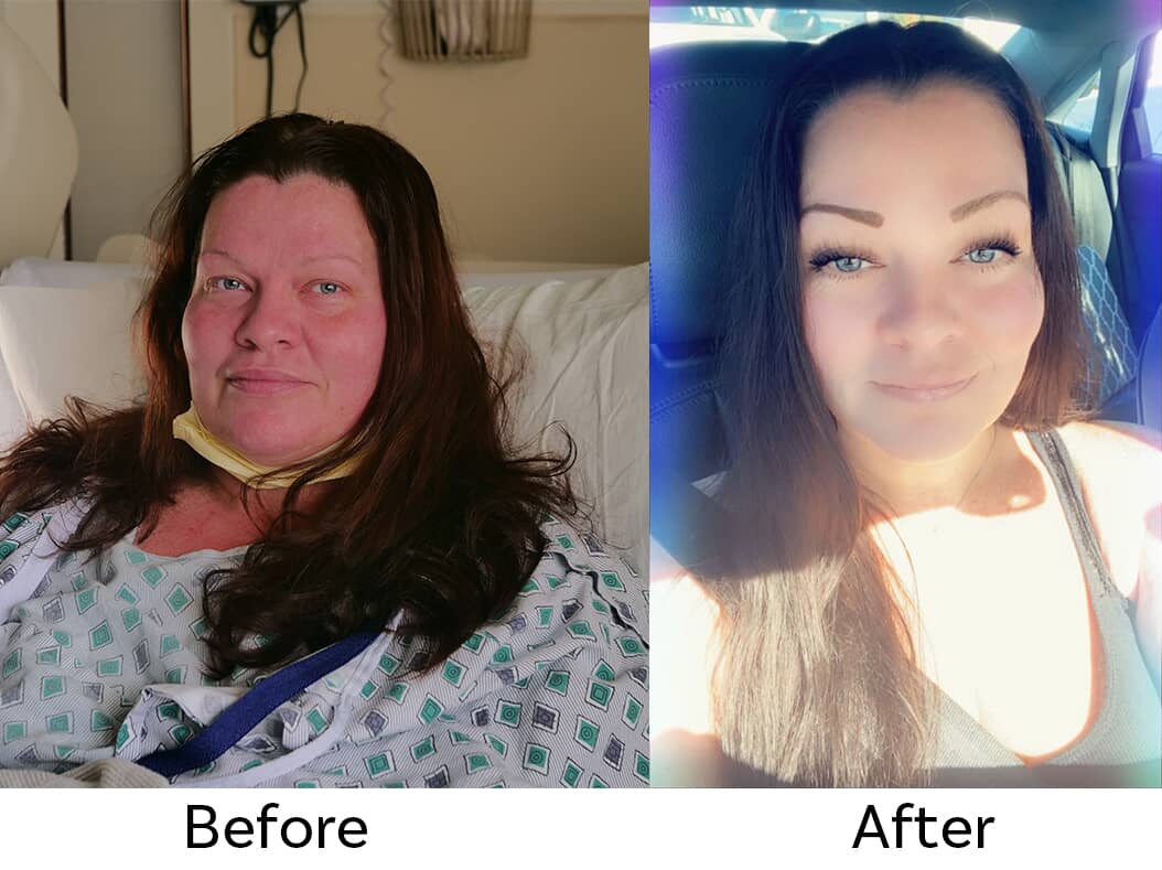 Beforeafter Lori Warren[4]